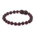 Baltic Amber Baby Teething Bracelet Baroque Dark Cognac Matte Finish - Wholesale Lot of 10pcs - 14cm / 5.5in - XB54DCM